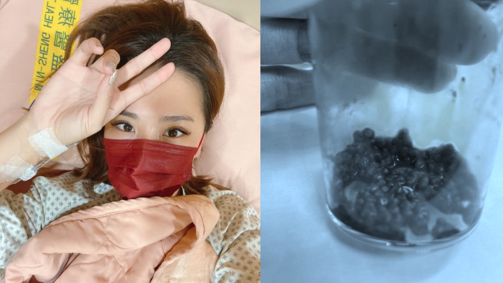 小禎爆過年前開刀  「晚一天就完蛋」