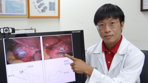 結紮後再自然懷孕？重建手術再現生機