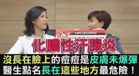 特殊部位的痘痘紅腫熱痛 原來是比青春痘更難纏的化膿性汗腺炎!