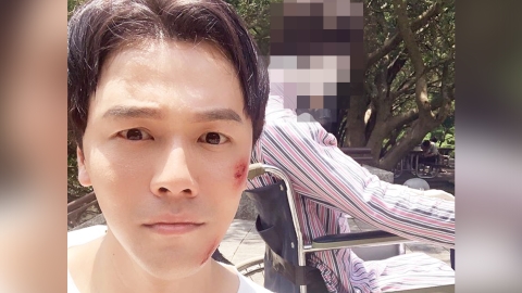 《多情城市》反派黃文星被推下樓全身傷!「替身」正面照曝光