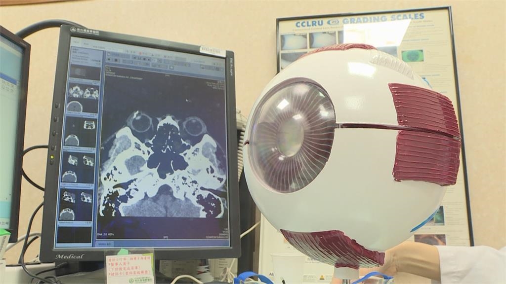 刷洗機台太用力？男遭飛出鋼絲扎進眼球