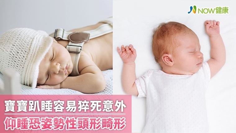寶寶睡姿影響健康 趴睡易猝死、仰睡恐姿勢性頭形畸形