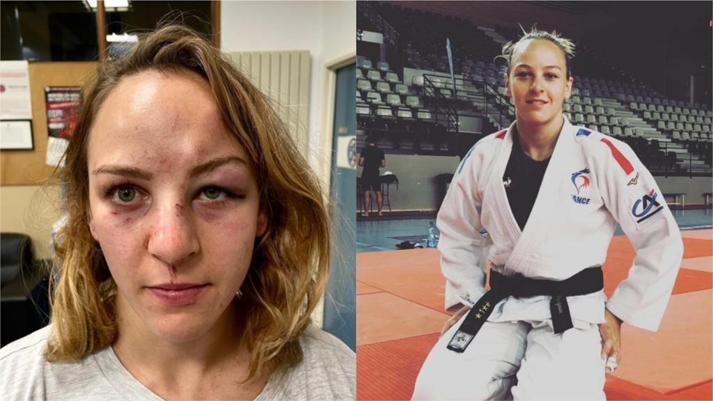 柔道／奧運女子金牌也遭施暴！慘被揍成「熊貓眼」男友「證據不足」釋放