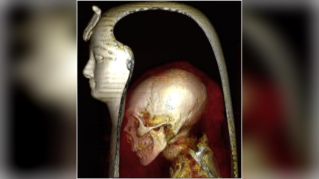 埃及「數位開箱」木乃伊　首揭法老王真面目