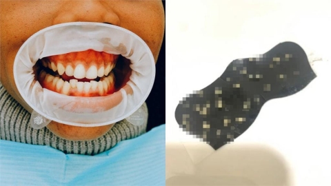 「喉嚨卡卡的」她擠出整排超臭米粒　衝擊畫面曝光網傻眼：挖礦大師？