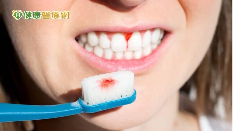 刷牙就流血當心變「無齒」 醫揪2元兇 刷牙就流血當心變「無齒」 醫揪2元兇