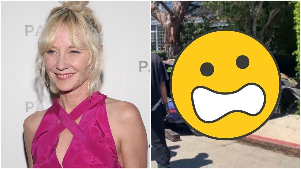 《六天七夜》女星失控撞民宅釀「火燒車」！安海契嚴重燒傷、插管命危