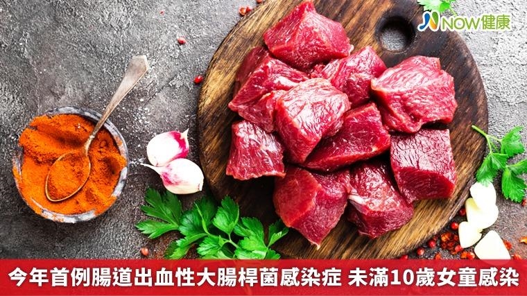 首例腸道出血性大腸桿菌感染症 未滿10歲女童感染