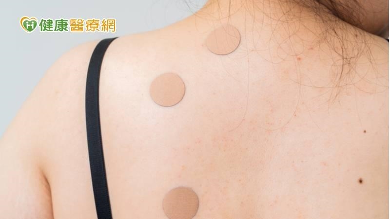 冬至後「做１事」助改善虛寒　但6族群最好問過醫師