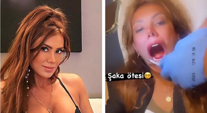 相約黑夜忘情喇舌!辣模法式吻「突現痛感」哀嚎 她傻了:舌頭缺一角