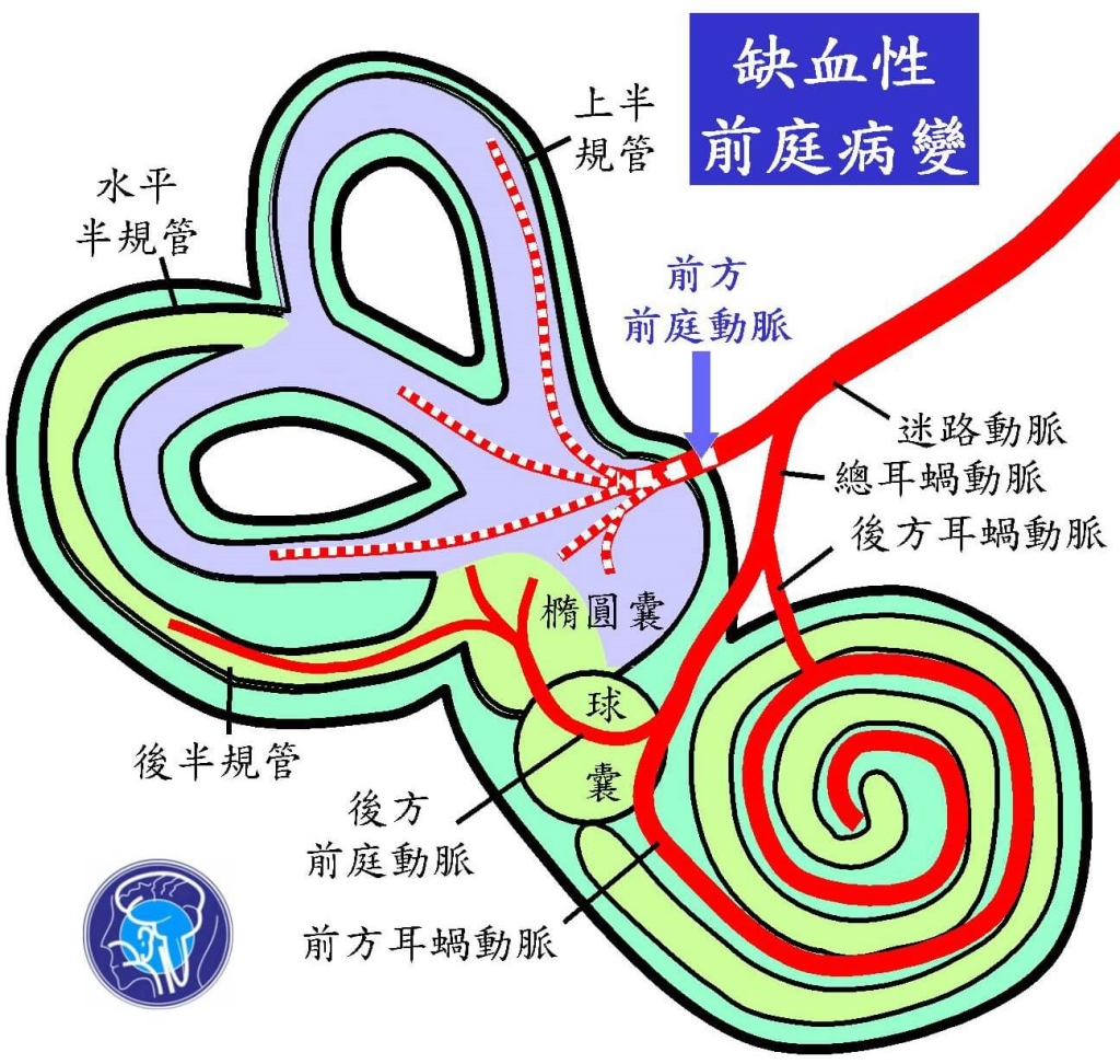 常眩暈可能血栓、中風警訊?醫指共同風險,盡早超音波檢查!