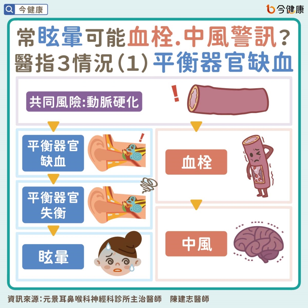 常眩暈可能血栓、中風警訊?醫指共同風險,盡早超音波檢查!
