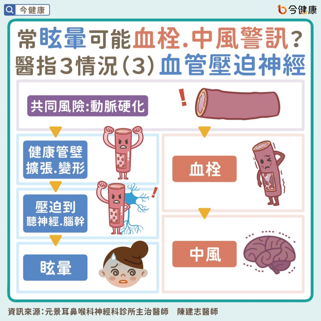 常眩暈可能血栓、中風警訊?醫指共同風險,盡早超音波檢查!