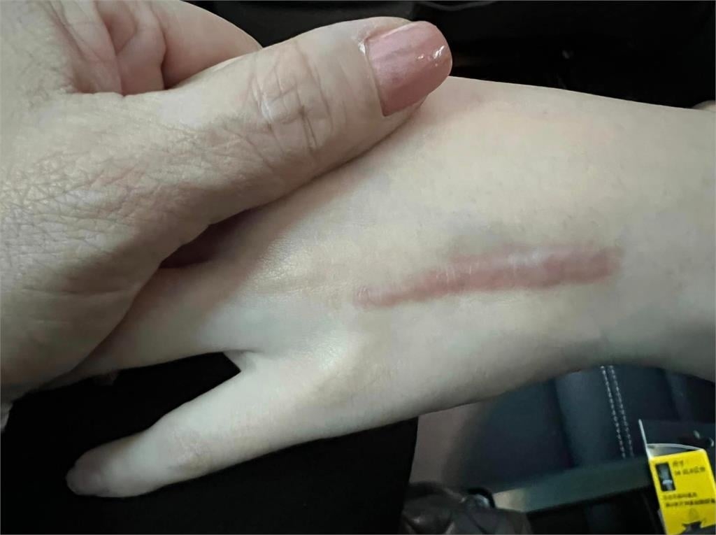 生日才剛過!王彩樺20歲愛女突開刀嚇壞粉絲:等待幸運之神降臨