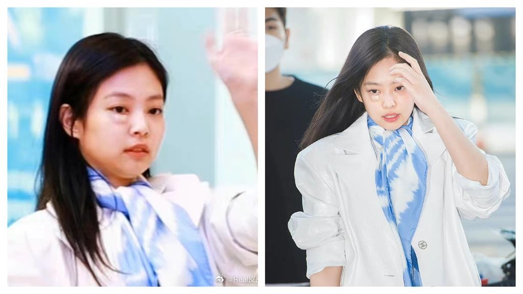 Jennie摔臉破相照流出!真面目崩壞「嚴重腫脹」網憂心:好可怕