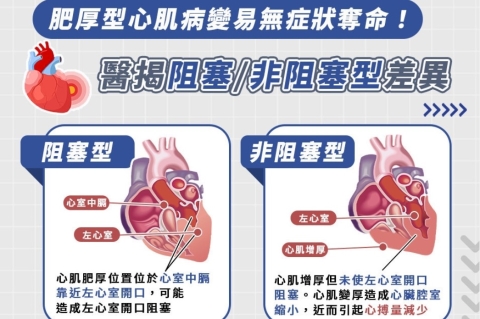 多數人體檢完才發現! 「肥厚型心肌病變」易無症狀奪命? 醫籲:遵從3措施防猝死