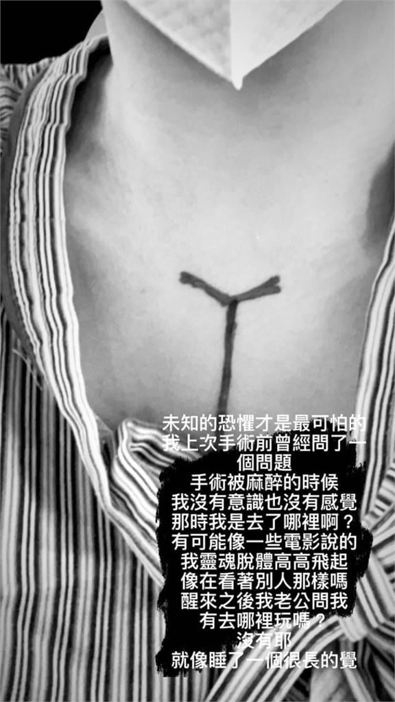 朱芯儀曬黑白手術照　嘆「未知恐懼最可怕」麻醉醒來老公1句話超暖