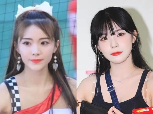 太漂亮遭疑後天美女!李多慧「舊照對比圖」流出…1部位消風網看傻