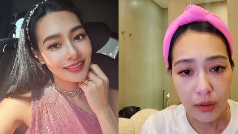 王思佳秒殺假包風波!曬「逆天娃娃臉」霸氣喊:早就忘光光疼痛