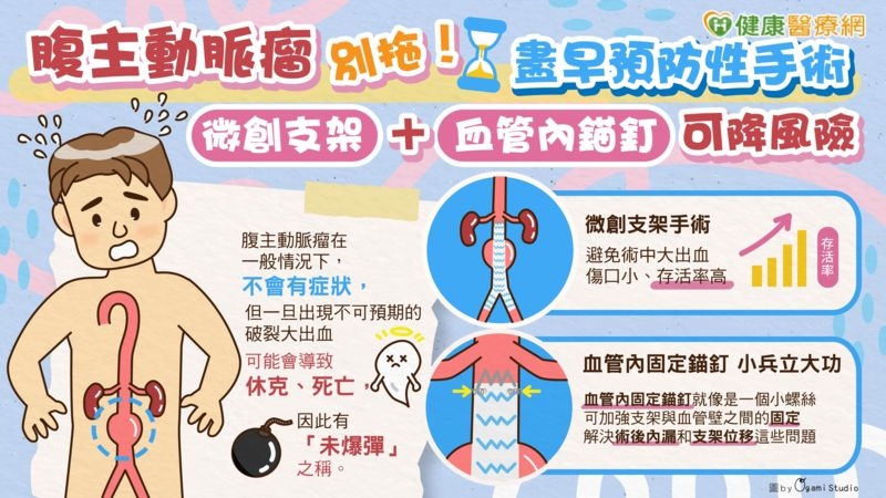 腹主動脈瘤別拖!盡早預防性手術 微創支架+血管內錨釘可降「這些」風險