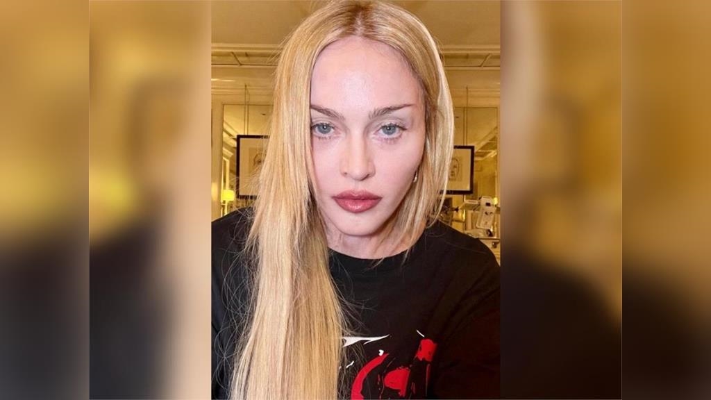 遭「謠傳腦死」演唱會急喊卡！　瑪丹娜親報平安：正在康復的路上