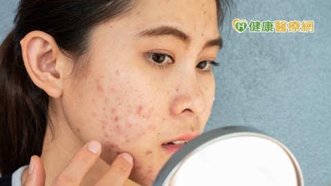 吃藥擔心副作用?療痘「心」選擇,擁有健康肌膚不是夢!