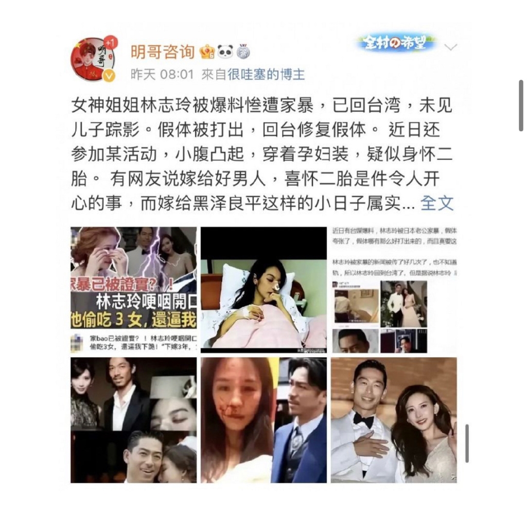快新聞/林志玲遭中網謠傳被老公打爛鼻子 駁斥甜喊:沒有家暴只有抱抱