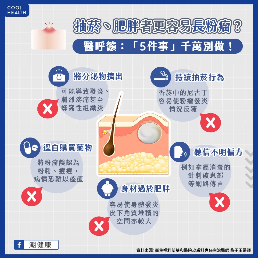 抽菸、肥胖者更容易長出粉瘤？  醫：去藥房買藥擦不會比較快好！