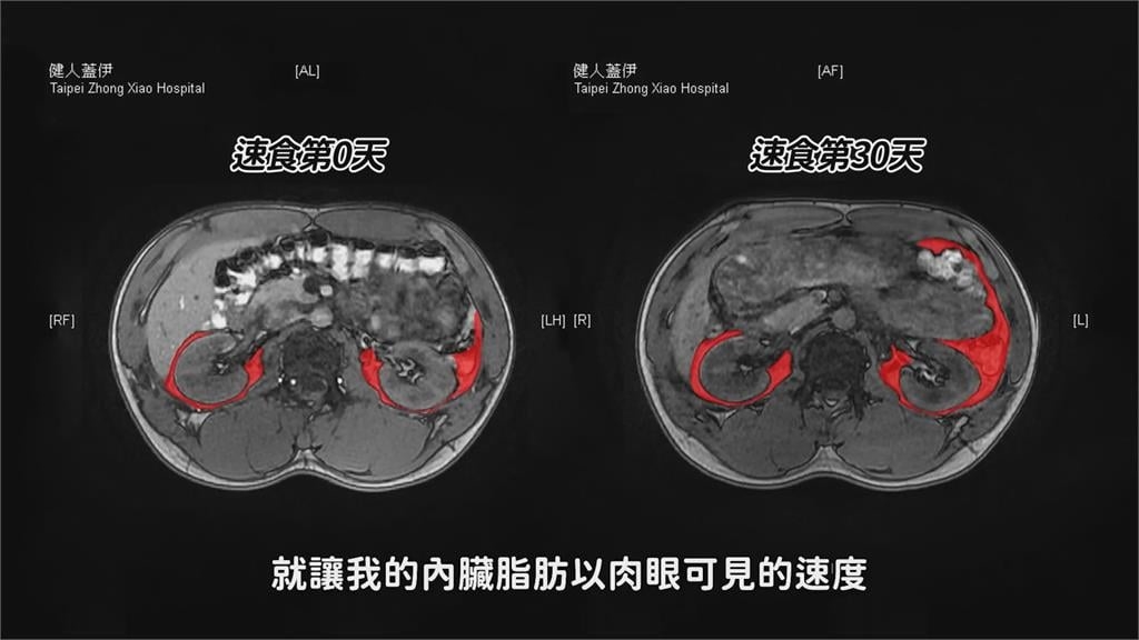 健身達人實測一個月只吃速食　結果曝網嚇傻：不敢再吃速食了