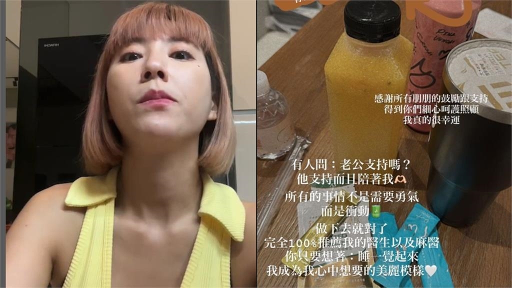 DJ妖嬌「醫美再升級進化」！曬術後照揭真實原因：演出真的很累
