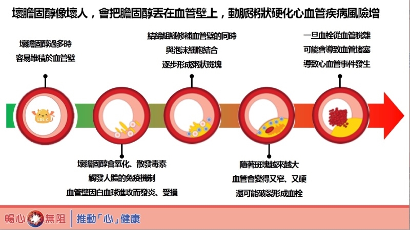 全台500萬人高血脂　「1不3要」遠離動脈粥狀硬化威脅
