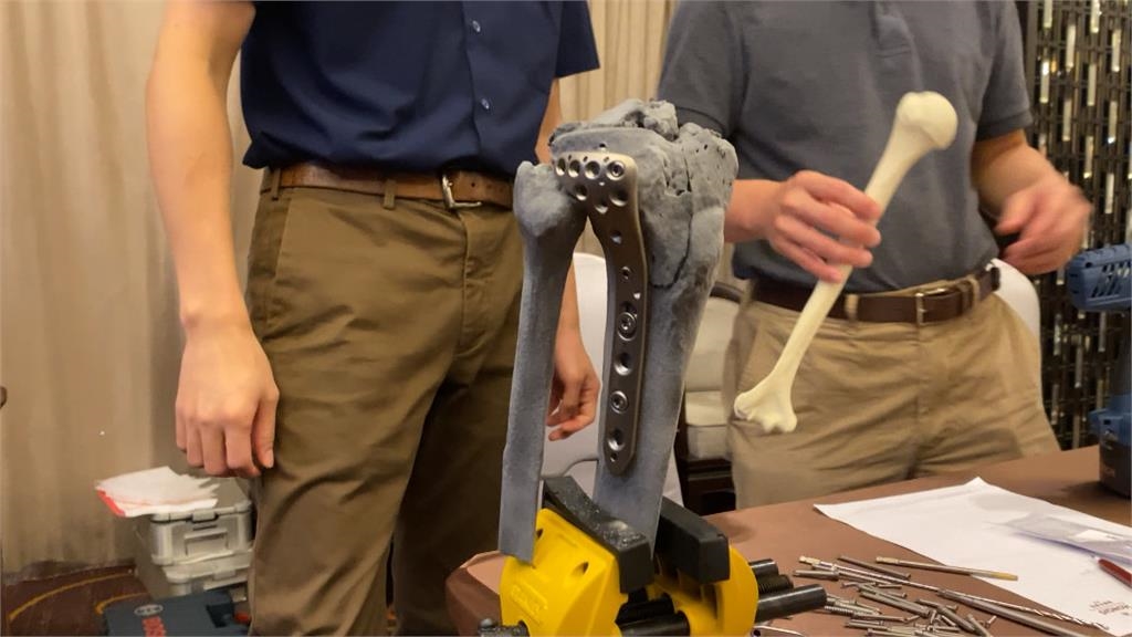 3D列印打造病人假骨　提供術前模擬降低風險