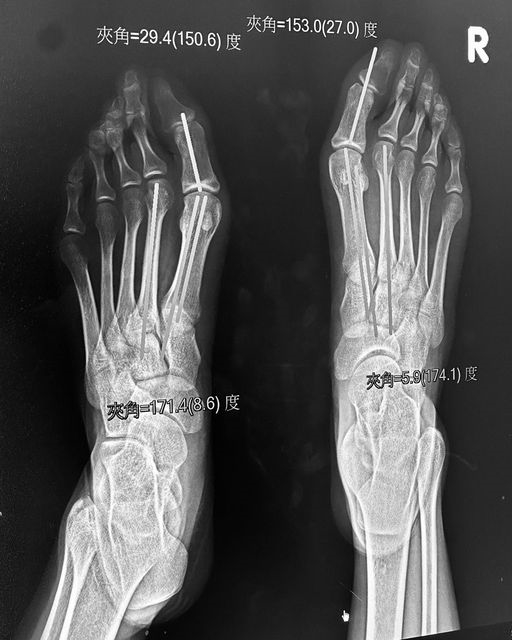 邵雨薇萬聖節曬照「1部位」全看光!眾人一看傻了:透視女明星內在