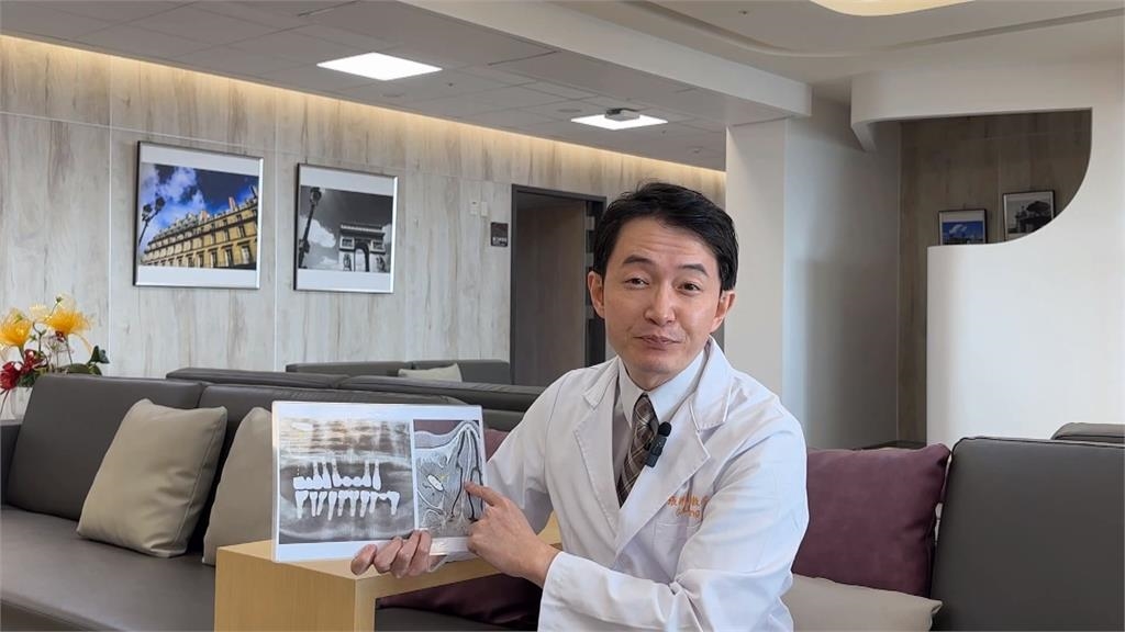 惱人!病患罹鼻竇炎無法根治 竟是植牙體掉進鼻竇腔