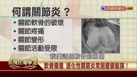 別讓體重成為膝關節負擔 關節疼痛腫脹都是警訊!