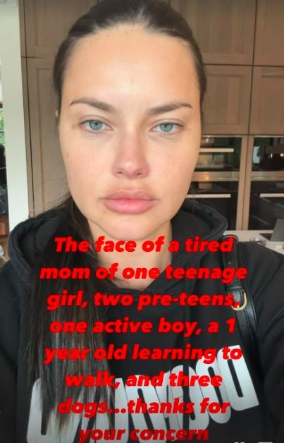 維密天使「腫成米龜」遭疑進廠維修！霸氣曬「無修素顏」反擊：疲憊媽媽臉