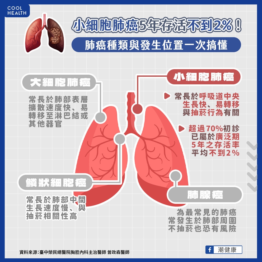 化療僅第一線有效但復發快速！  小細胞肺癌面臨治療瓶頸