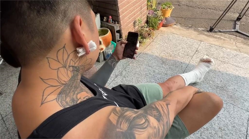 攏系阿共仔a陰謀啦！他跳《科目三》竟變「骨折三」　苦主現身還原