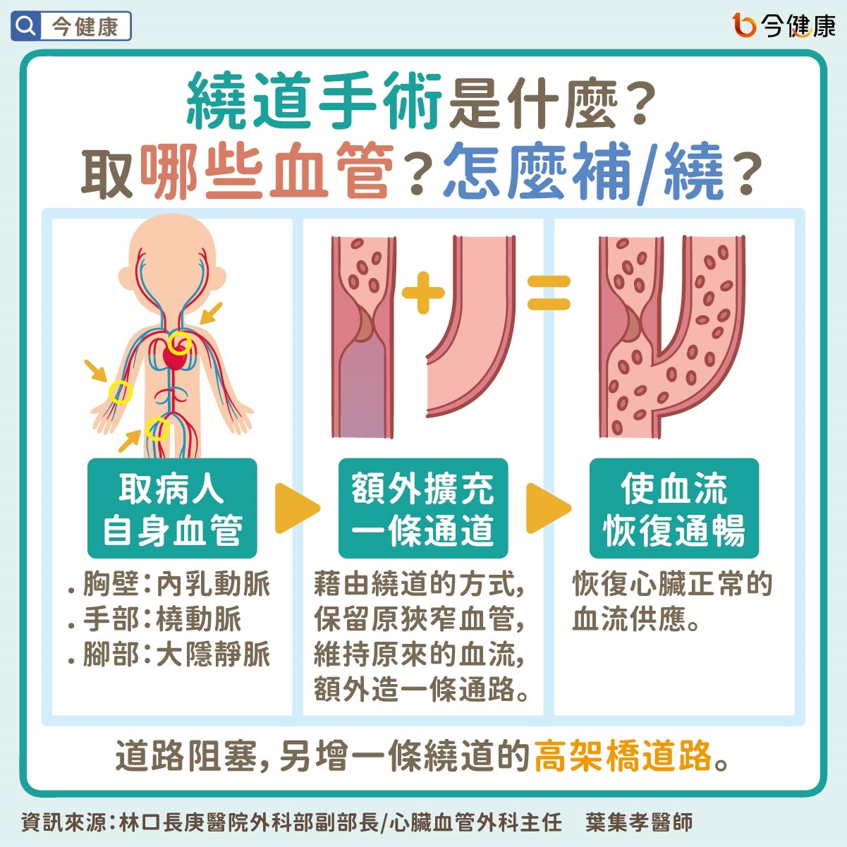 心肌梗塞有徵兆？有家族史怎麼控制？醫詳解冠狀動脈繞道手術與心臟支架手術