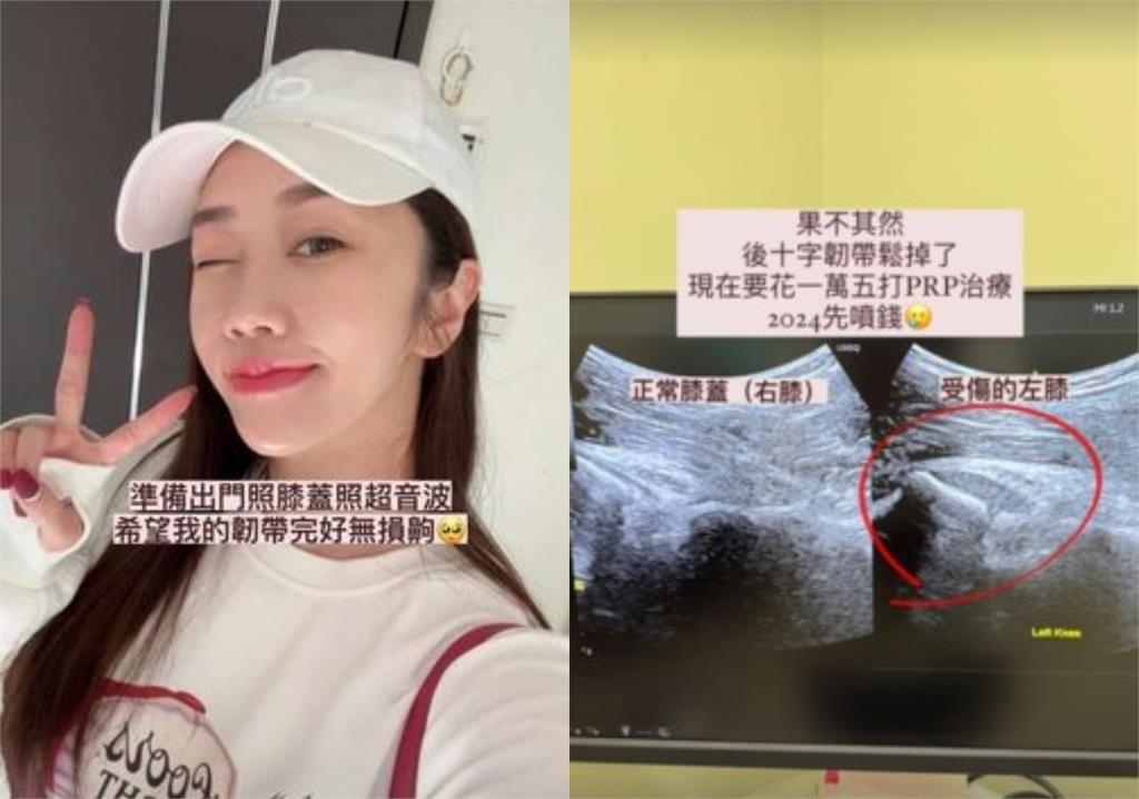 「最美空姐」結婚堅決不生!突曬超音波網狂喊恭喜…她揭真相:秒噴1萬5