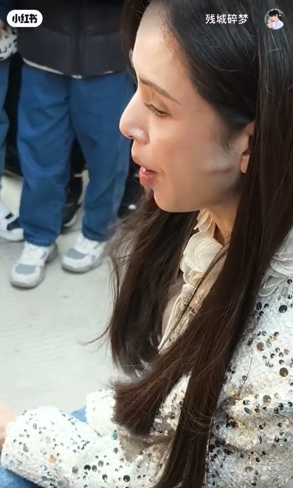 最美小龍女臉頰驚見「詭異凸起」!罹怪病「終生不會好」57歲近況曝