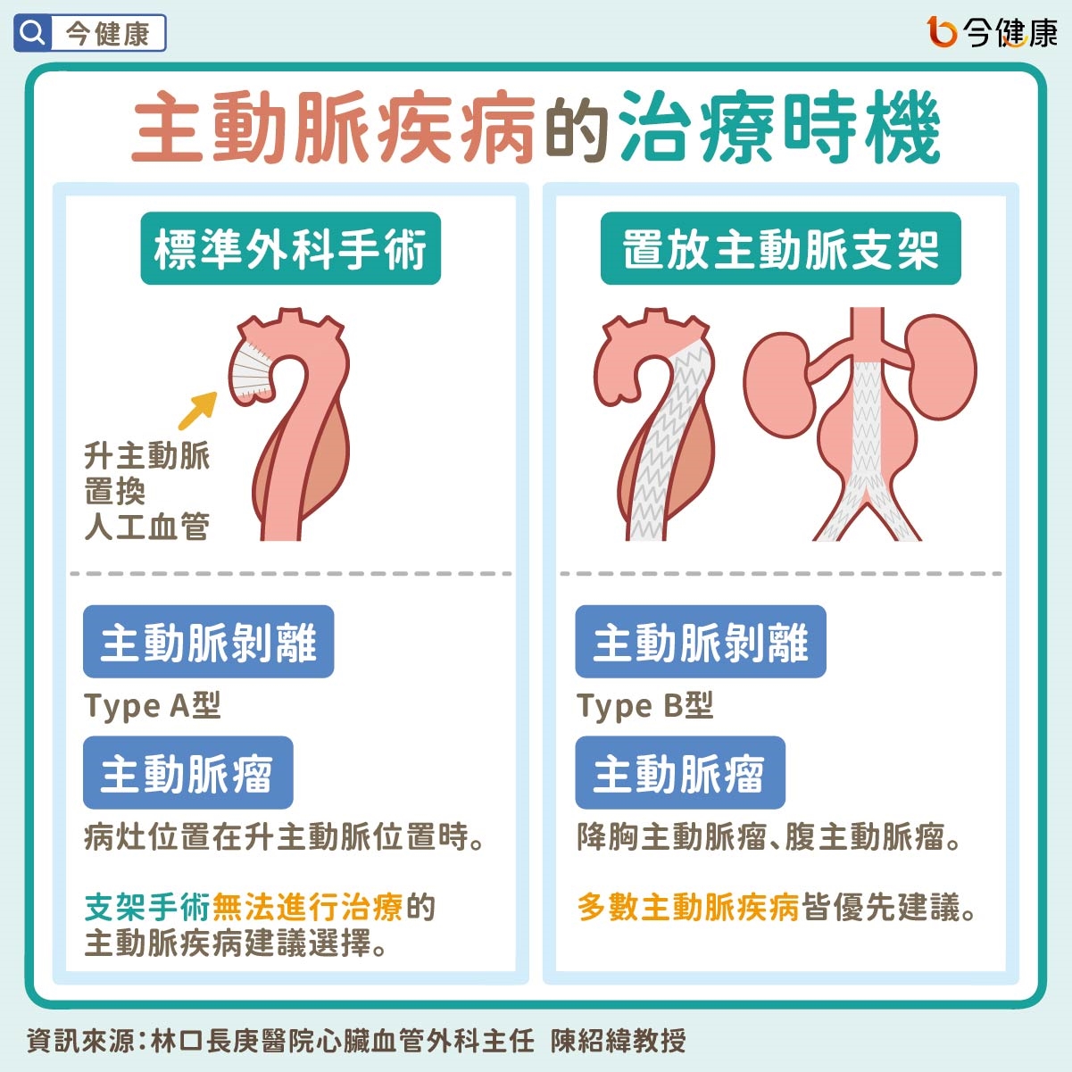病人最常霧煞煞的主動脈疾病──沒症狀還是要治療？主動脈瘤不是腫瘤？主動脈支架手術是什麼？
