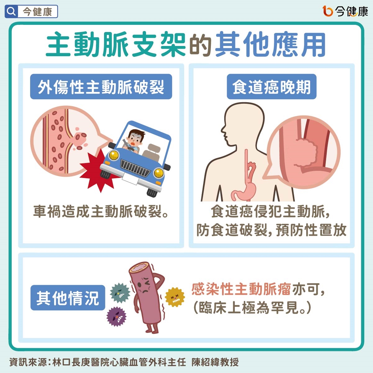 病人最常霧煞煞的主動脈疾病──沒症狀還是要治療？主動脈瘤不是腫瘤？主動脈支架手術是什麼？