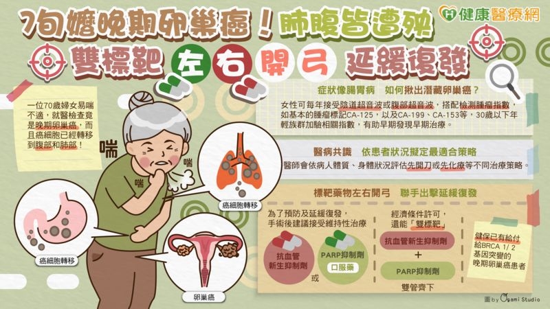 7旬嬤晚期卵巢癌!肺腹皆遭殃 雙標靶「左右開弓」延緩復發