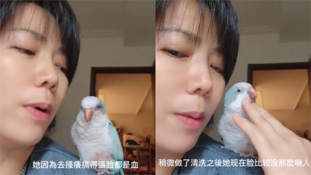 陳仙梅「血沾滿臉」近況惹網心疼!「一刀下去大噴血」他嚇壞:好像殺人犯