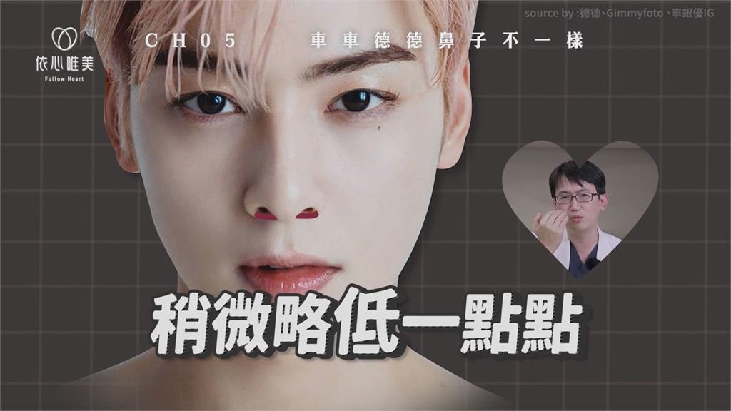 臉蛋天才!整形醫分析德德五官優勢 指1點贏車銀優:上輩子拯救宇宙