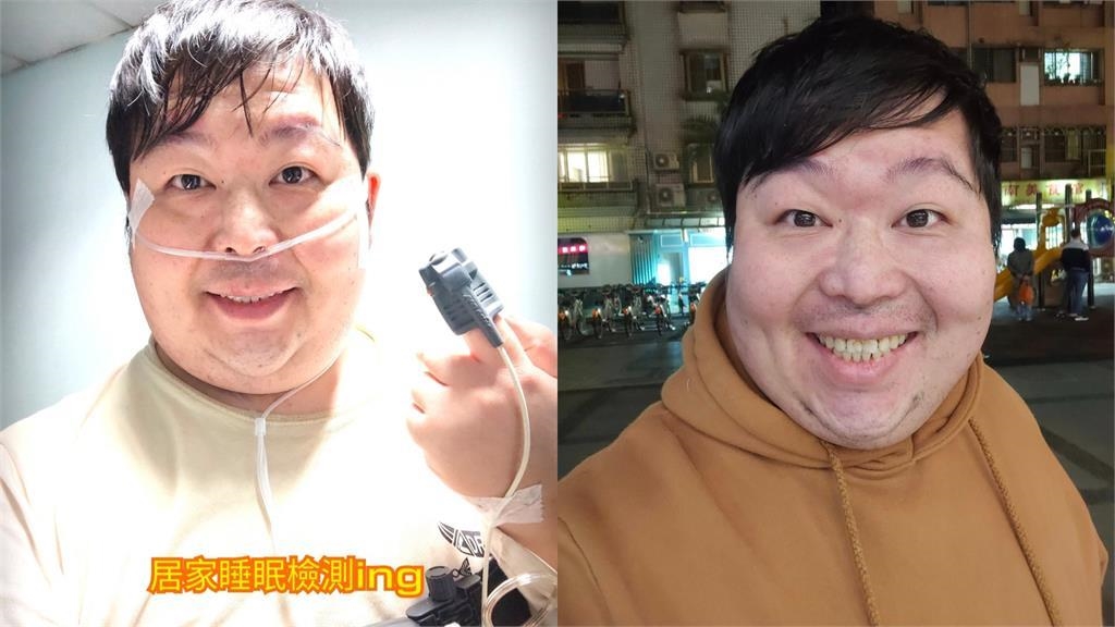 患睡眠呼吸中止症!山豬「一晚斷氣超過100次」 遭醫警告將引「9共病」 患睡眠呼吸中止症!山豬「一晚斷氣超過100次」 遭醫警告將引「9共病」