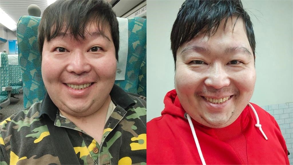 患睡眠呼吸中止症!山豬「一晚斷氣100次↑」 遭醫警告將引「9共病」