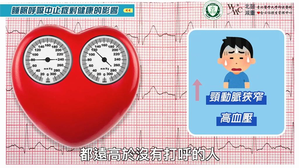 山豬生前曾因睡眠呼吸中止症「一晚斷氣19次」！醫曝打呼損害健康　性功能也有影響