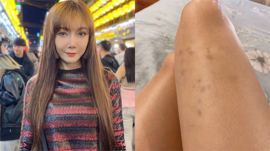 58歲絕頂美魔女「自曝被打到瘀青」！13秒遭動手畫面流出…網急關切